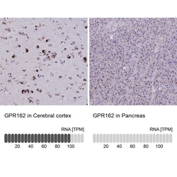 GPR162 Antibody, Novus Biologicals 0.1mL; Unlabeled:Antibodies, Polyclonal